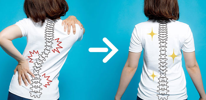 chiropractic for good posture in Orange, CA