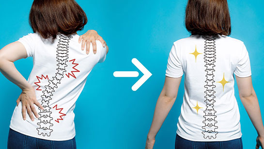 chiropractic for good posture in Orange, CA