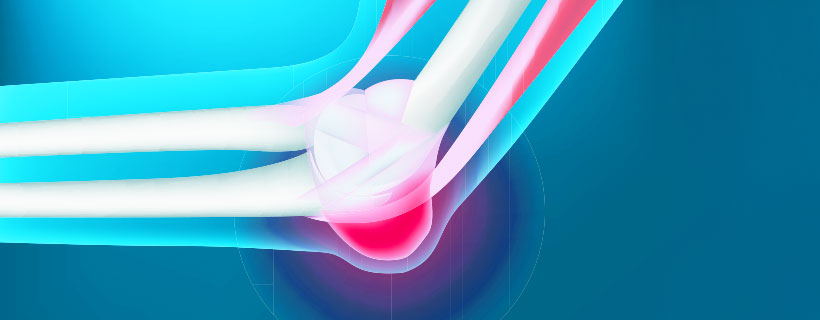patient needing bursitis treatment in Orange