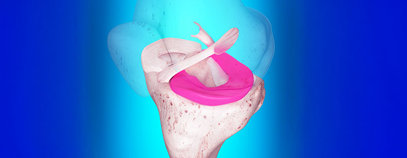 patient needing ligamentitis treatment in Orange