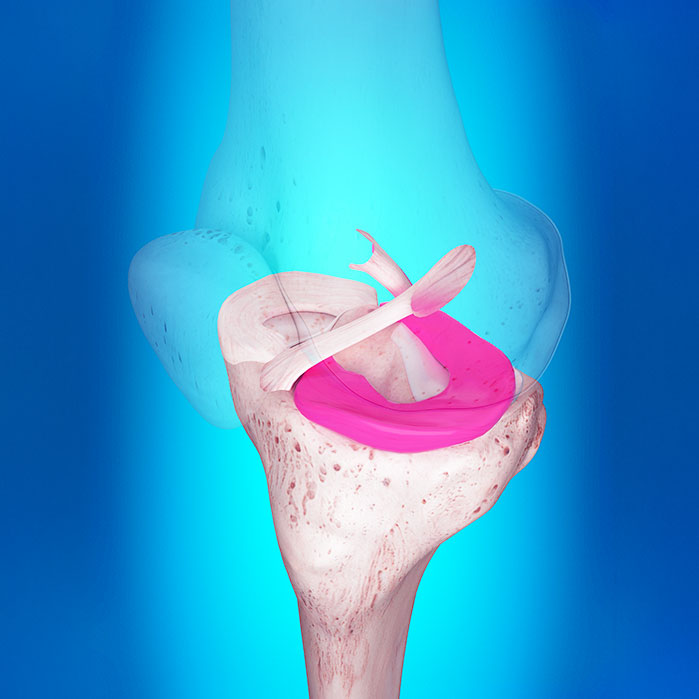 ligamentitis chiropractor in Orange, CA
