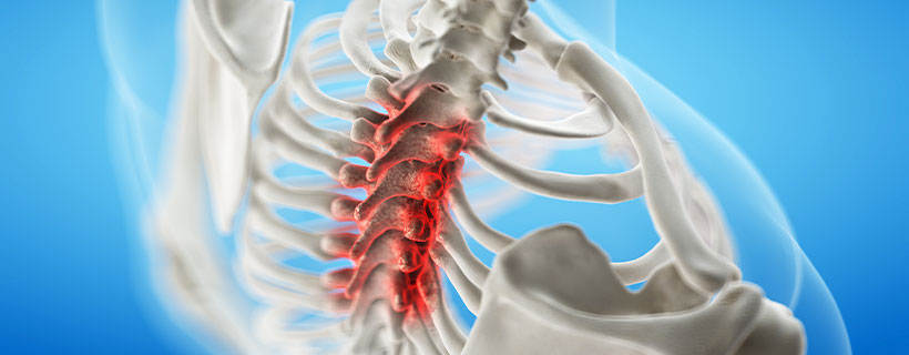 patient needing spinal stenosis treatment in Orange